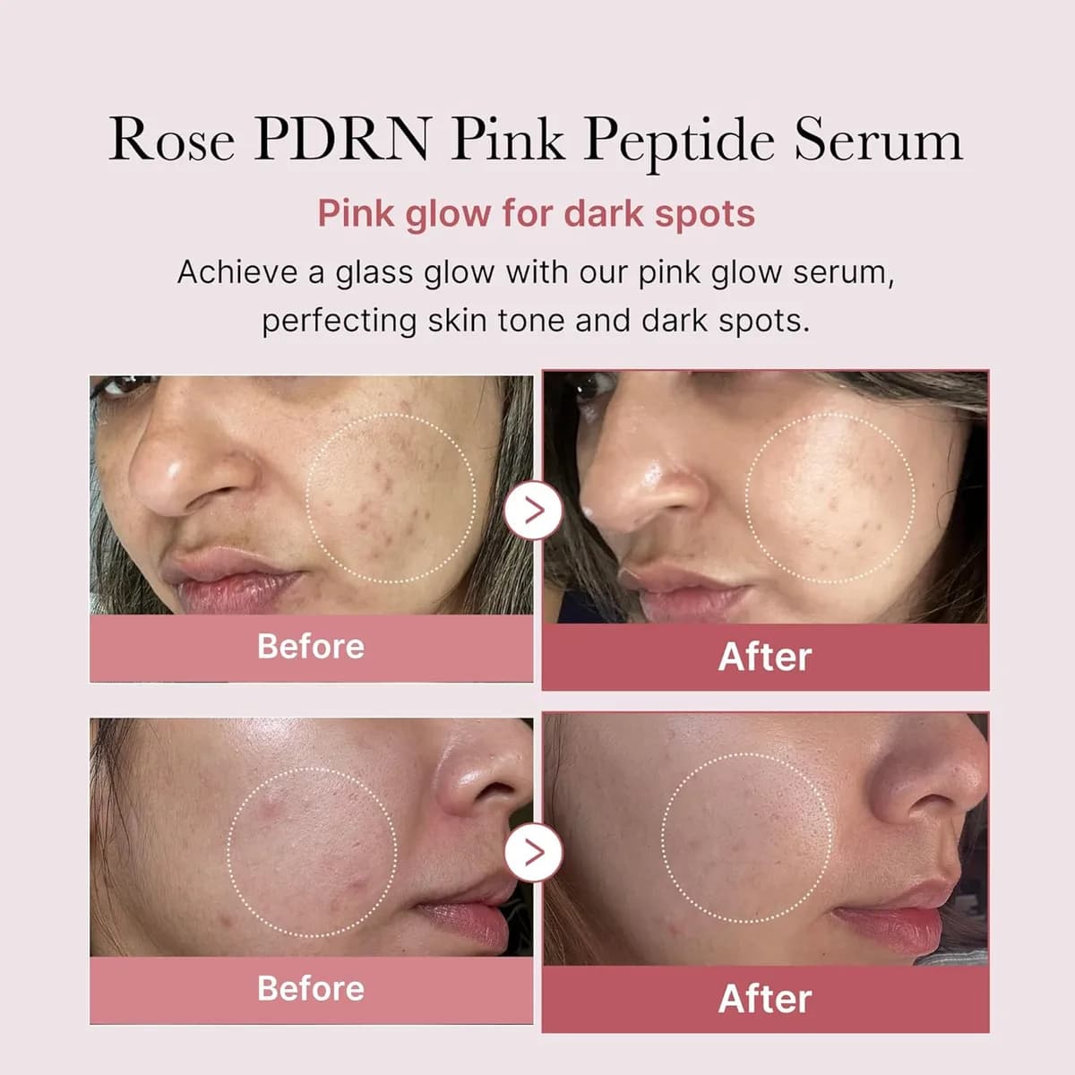 Medicube PDRN Serum Multipéptido Ácido Hialurónico