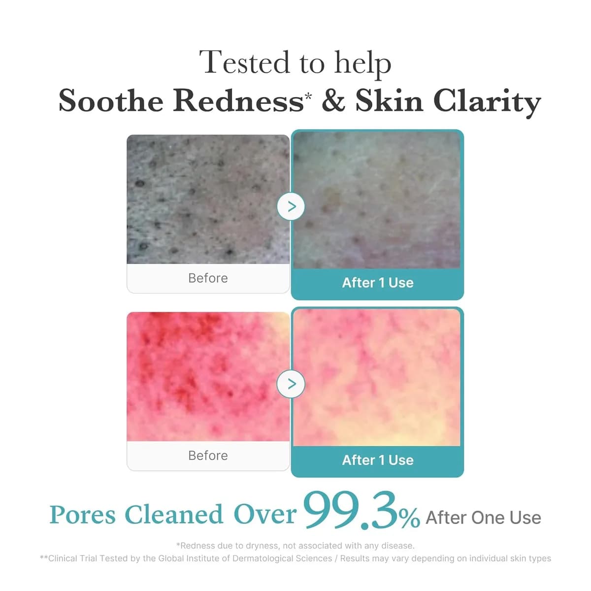 Medicube Deep Azelaic Acid + Niacinamide Foam Cleanser