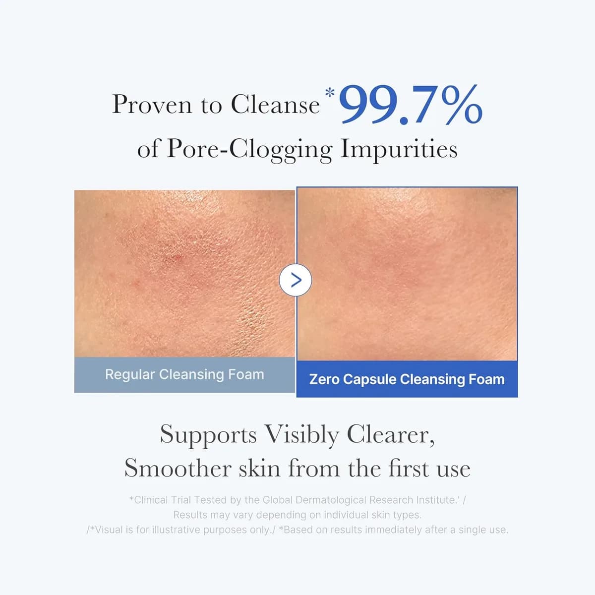 Medicube Zero Pore Clear Blue Deep Facial Cleanser